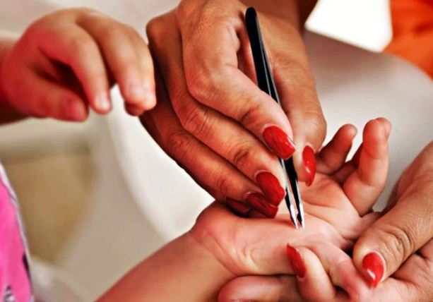 7 Spiritual Meanings of Dreaming of Thorns on Hands