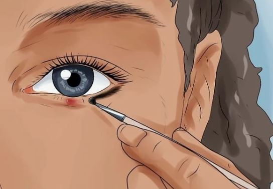 The spiritual significance of dreaming of stye