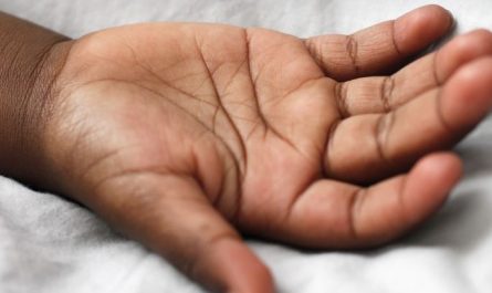 6 Spiritual Meanings of Dreaming of swollen hands