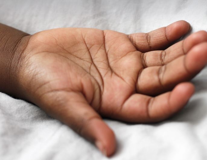6 Spiritual Meanings of Dreaming of swollen hands