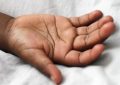 7 Spiritual Meanings of Dreaming of Having My Hand chopped off