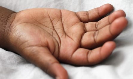 7 Spiritual Meanings of Dreaming of Having My Hand chopped off