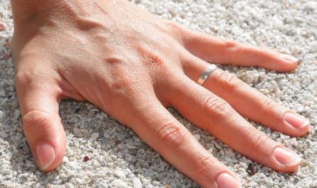 7 Spiritual Meanings of Dreaming of Finger Cutting off