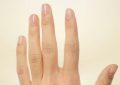 6 Spiritual Meanings of Dreaming of Broken Fingers