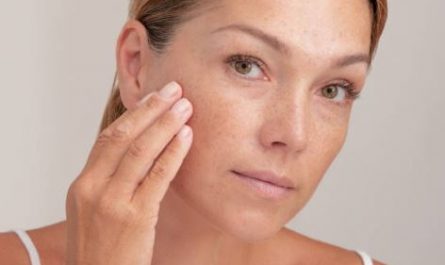 15 Spiritual Meanings of Dreaming of Melasma