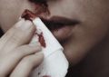 10 Interpretations of Dreaming About Nosebleeds