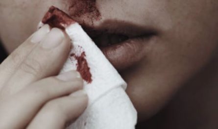 10 Interpretations of Dreaming About Nosebleeds