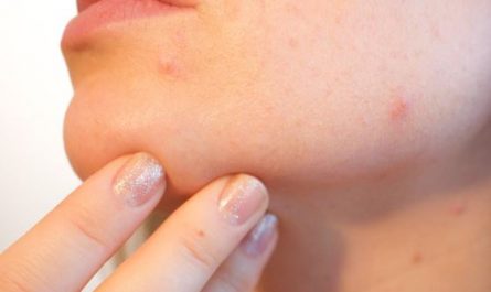 13 Interpretations of Dreams about Pus