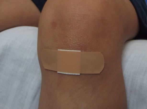 8 Spiritual Meanings of Dreaming about Bruises